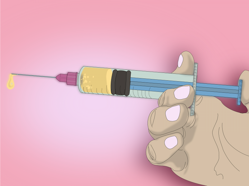 Parlons donc des différentes maladies sexuellement transmissible.